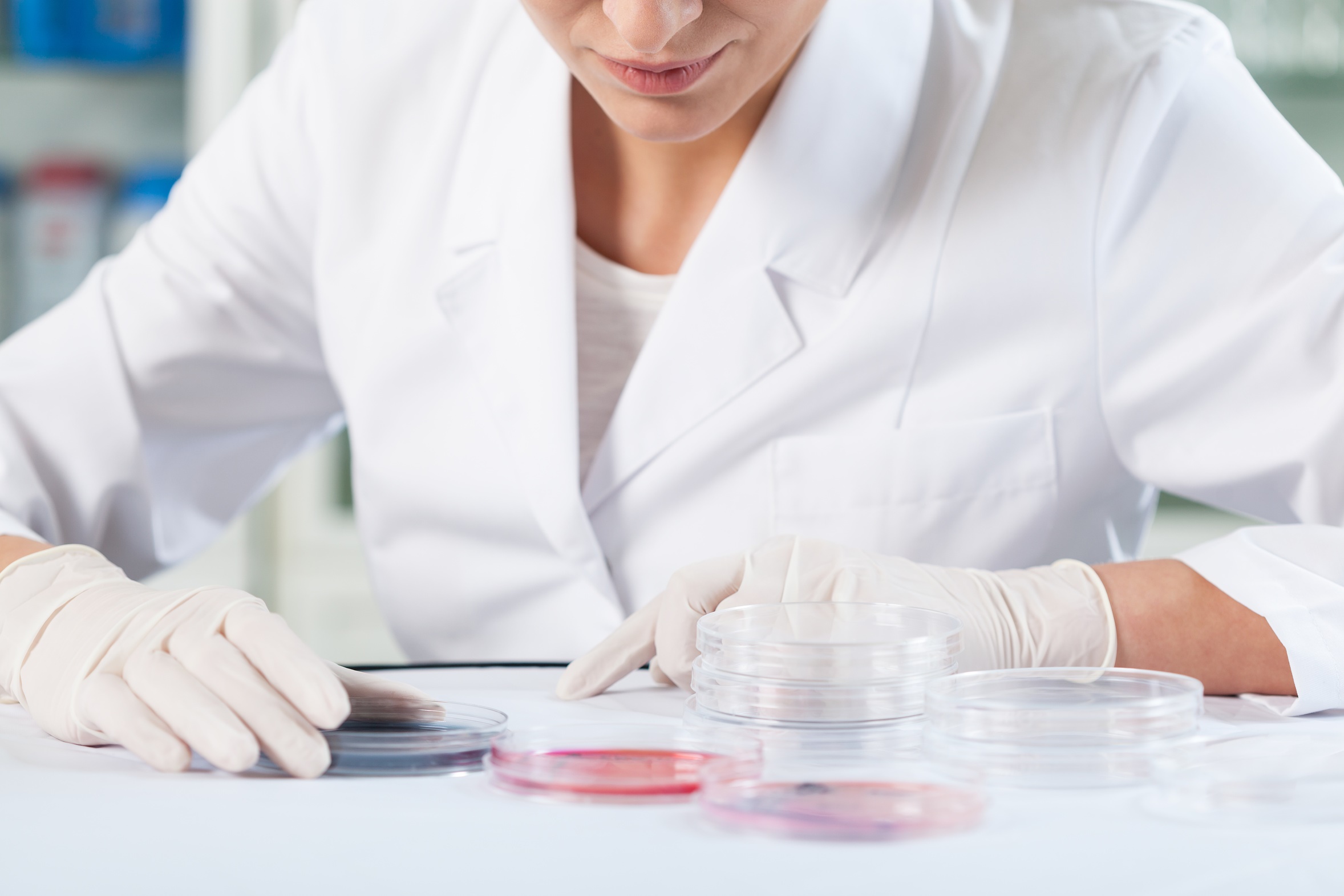 Scientist checking Petri dishes